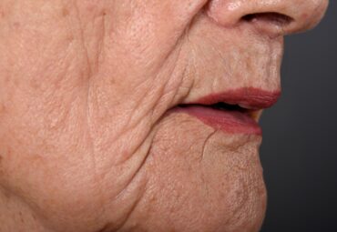 Allure, Aesthetic Clinic AT Washington 5